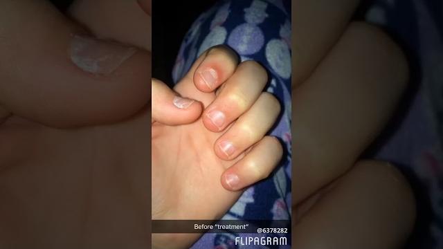 Nail growth journey 1// day 1 to 80 Nail growth journey 1// day 1 to 80