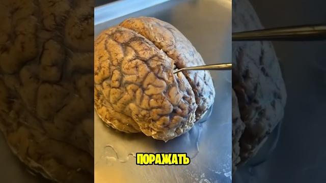 Гидрофобия Последний Этап Бешенства Гидрофобия Последний Этап Бешенства
