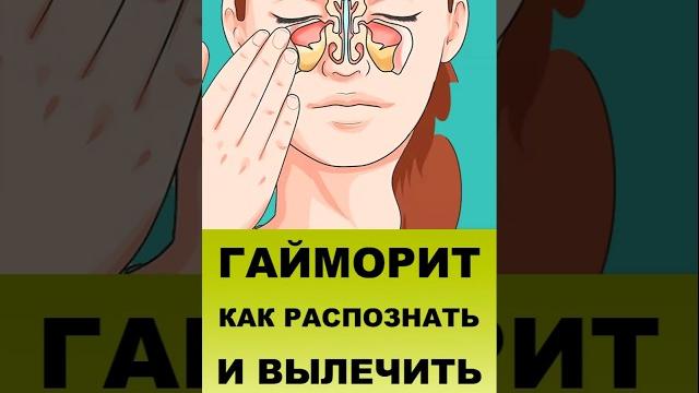 ГАЙМОРИТ И СИНУСИТЫ. Как помочь себе? ГАЙМОРИТ И СИНУСИТЫ. Как помочь себе?