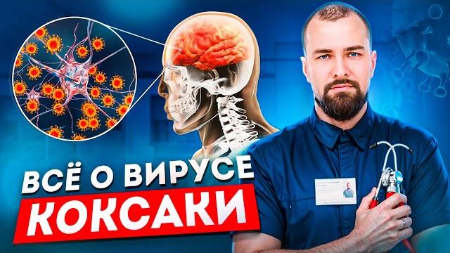 Энтеровирусная инфекция (Коксаки) Энтеровирусная инфекция (Коксаки)