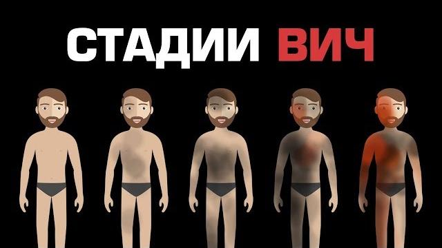 ЧТО ПРОИСХОДИТ С ЧЕЛОВЕКОМ, ЗАРАЖЁННЫМ ВИЧ? ЧТО ПРОИСХОДИТ С ЧЕЛОВЕКОМ, ЗАРАЖЁННЫМ ВИЧ?