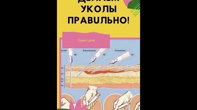 Как делать внутримышечный укол в ягодицу. Как делать уколы в ягодичную мышцу. Укол внутримышечный Как делать внутримышечный укол в ягодицу. Как делать уколы в ягодичную мышцу. Укол внутримышечный