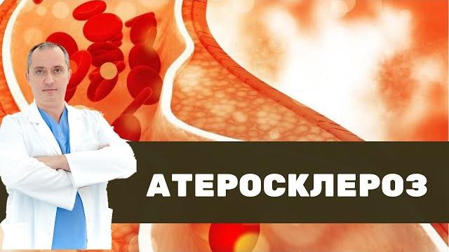 Что такое атеросклероз на самом деле? Что такое атеросклероз на самом деле?