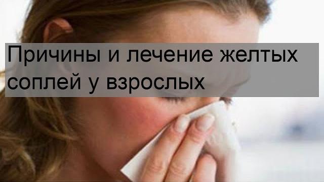Причины и лечение желтых соплей у взрослых Причины и лечение желтых соплей у взрослых