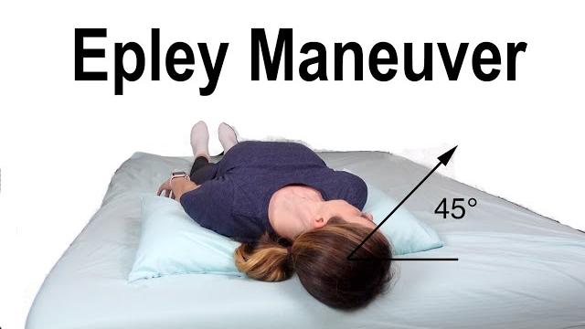 Epley Maneuver to Treat BPPV Dizziness Epley Maneuver to Treat BPPV Dizziness