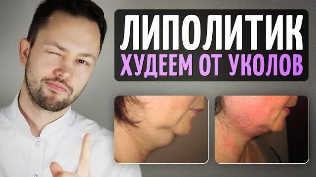 Как похудеть от уколов. Липолитики. Как похудеть от уколов. Липолитики.