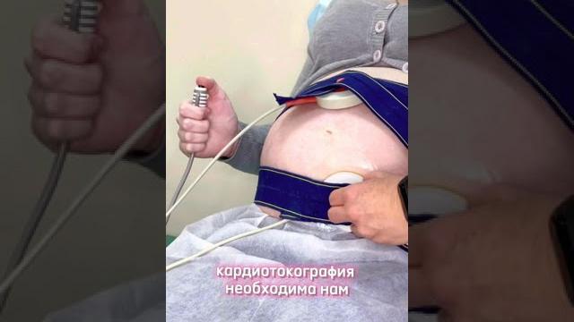 Кардиотокограмма Кардиотокограмма
