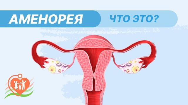 Аменорея / Почему исчезли менструации? Аменорея / Почему исчезли менструации?