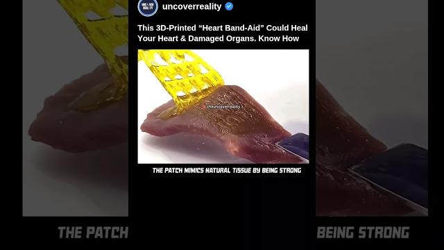 This 3D printed Heart Band Aid Could Heal Heart & Damaged Organ. Know How #medical #shorts #tech This 3D printed Heart Band Aid Could Heal Heart & Damaged Organ. Know How #medical #shorts #tech
