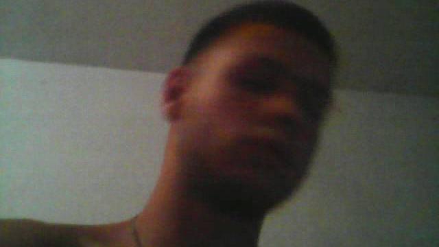 Дефислез. Закапавыем глаза Дефислез. Закапавыем глаза