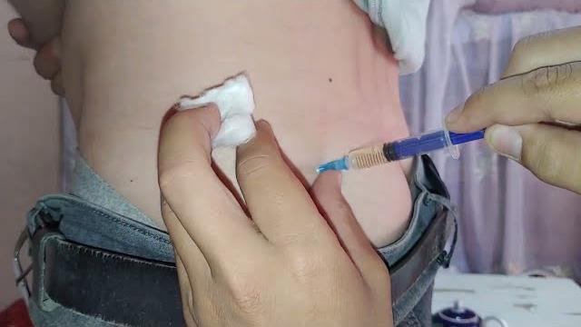 Intramuscular injection. injection in the buttock Intramuscular injection. injection in the buttock