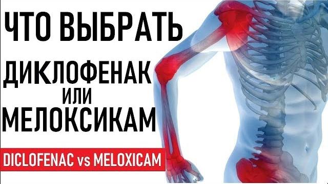 Мелоксикам или Диклофенак что лучше | СОВЕТЫ | Diclofenac (Voltaren) versus Meloxicam (Mobic) Мелоксикам или Диклофенак что лучше | СОВЕТЫ | Diclofenac (Voltaren) versus Meloxicam (Mobic)