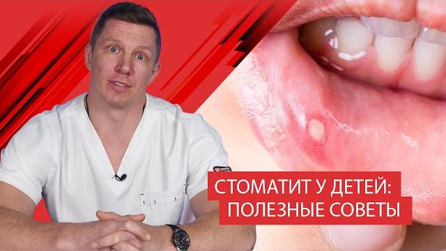 Стоматит у детей: полезные советы Стоматит у детей: полезные советы
