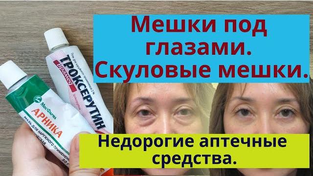 Мешки под глазами, малярные мешки, отеки глаз. Бюджетные аптечные средства от мешков под глазами. Мешки под глазами, малярные мешки, отеки глаз. Бюджетные аптечные средства от мешков под глазами.