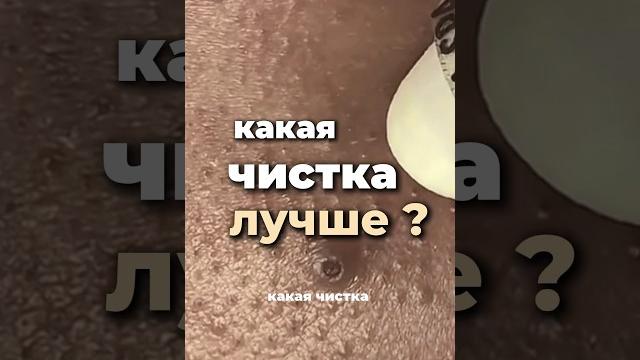 Какая чистка кожи лучше ? Вакуум ,ультразвук , механическая ,гайд по уходу в лс#кожа #уходзакожей Какая чистка кожи лучше ? Вакуум ,ультразвук , механическая ,гайд по уходу в лс#кожа #уходзакожей