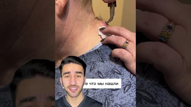 толстокожий мужчина толстокожий мужчина
