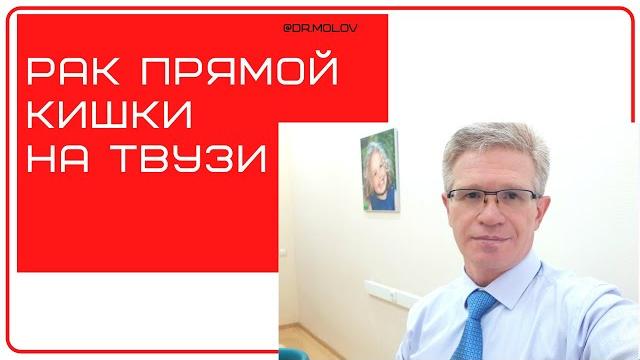 Рак прямой кишки на УЗИ малого таза Рак прямой кишки на УЗИ малого таза