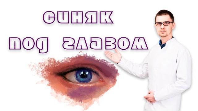 Синяк под глазом от удара Синяк под глазом от удара