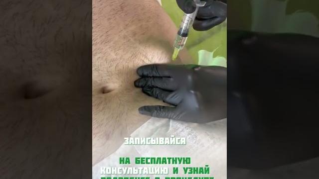 Липолитики Липолитики