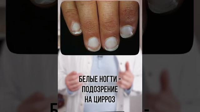 Проверь свои ногти! Диагностика по ногтям #shorts Проверь свои ногти! Диагностика по ногтям #shorts