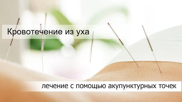 Кровотечение из уха Кровотечение из уха