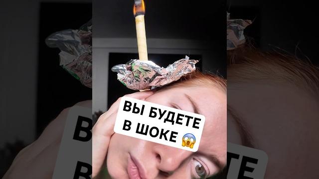 КАК ДЕЙСТВУЕТ УШНАЯ СВЕЧКА?! #уши #сера #чистка #обзор #обзоры #распаковка #жизньвсша #сша2024 КАК ДЕЙСТВУЕТ УШНАЯ СВЕЧКА?! #уши #сера #чистка #обзор #обзоры #распаковка #жизньвсша #сша2024