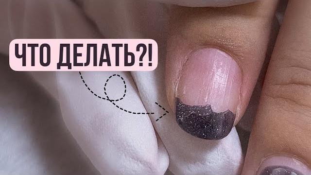 СКРЫТЫЕ причины отслоек гель лака! НЕ ДЕРЖИТСЯ ГЕЛЬ ЛАК! Маникюр подписчице ОТСЛОЙКИ У КУТИКУЛЫ СКРЫТЫЕ причины отслоек гель лака! НЕ ДЕРЖИТСЯ ГЕЛЬ ЛАК! Маникюр подписчице ОТСЛОЙКИ У КУТИКУЛЫ