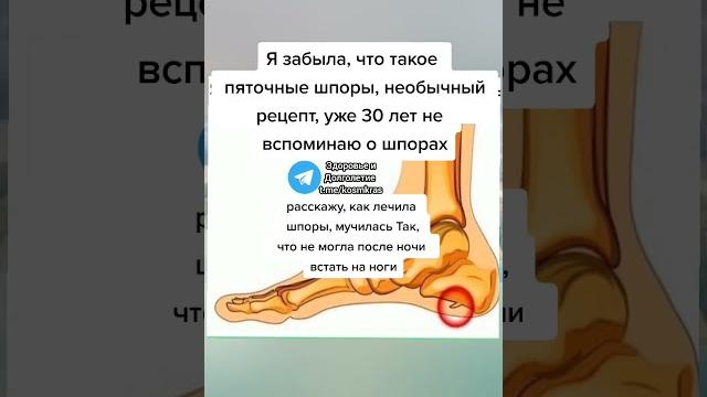 Я забыла что такое пяточные шпоры необычный рецепт. уже 30 лет не вспоминаю о шпорах #здоровье Я забыла что такое пяточные шпоры необычный рецепт. уже 30 лет не вспоминаю о шпорах #здоровье