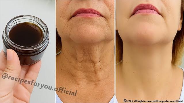 Anti aging magic oil, This oil will erase all the wrinkles on your face, stronger than Botox Anti aging magic oil, This oil will erase all the wrinkles on your face, stronger than Botox