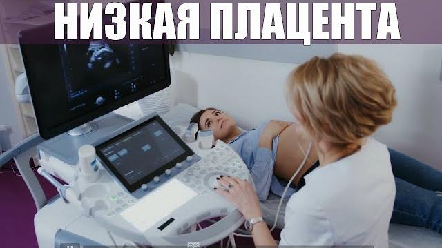 НИЗКОЕ РАСПОЛОЖЕНИЕ ПЛАЦЕНТЫ ВО ВРЕМЯ БЕРЕМЕННОСТИ | Чем опасно низкое расположение плаценты НИЗКОЕ РАСПОЛОЖЕНИЕ ПЛАЦЕНТЫ ВО ВРЕМЯ БЕРЕМЕННОСТИ | Чем опасно низкое расположение плаценты