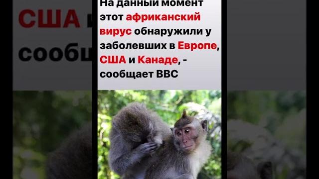 Обезьянья оспа Обезьянья оспа