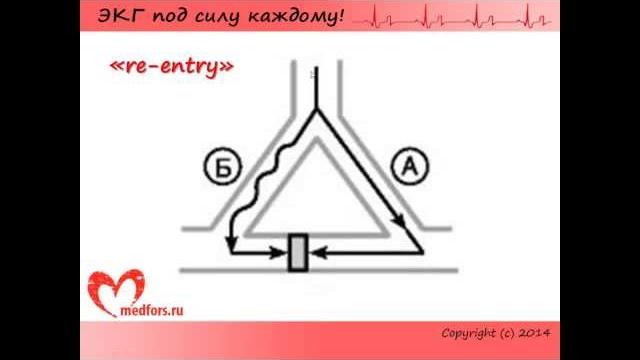 Урок 5. Видеокурс "ЭКГ под силу каждому". Урок 5. Видеокурс "ЭКГ под силу каждому".