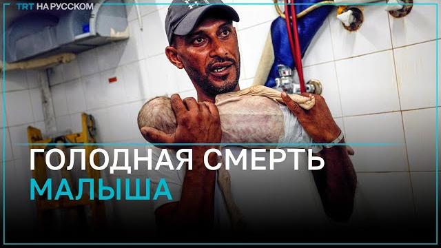 В Газе из-за недоедания умер 7-месячный малыш В Газе из-за недоедания умер 7-месячный малыш