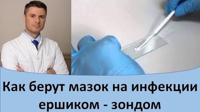 Как берут мазок на инфекции ершиком - зондом Как берут мазок на инфекции ершиком - зондом