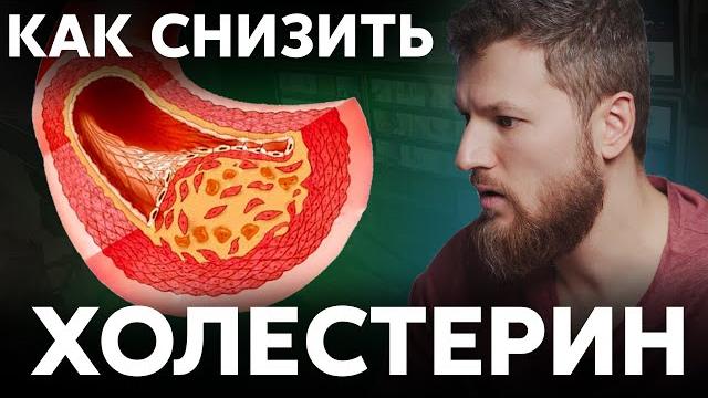 Как снизить ХОЛЕСТЕРИН, избавляемся от атеросклероза Как снизить ХОЛЕСТЕРИН, избавляемся от атеросклероза