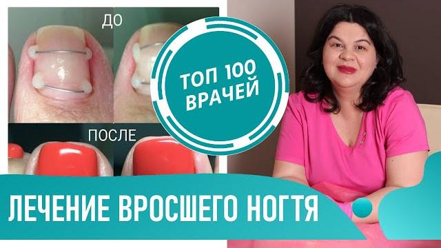 Как лечить Вросший Ноготь на ноге. Лечение и удаление вросшего ногтя на большом пальце ноги Как лечить Вросший Ноготь на ноге. Лечение и удаление вросшего ногтя на большом пальце ноги
