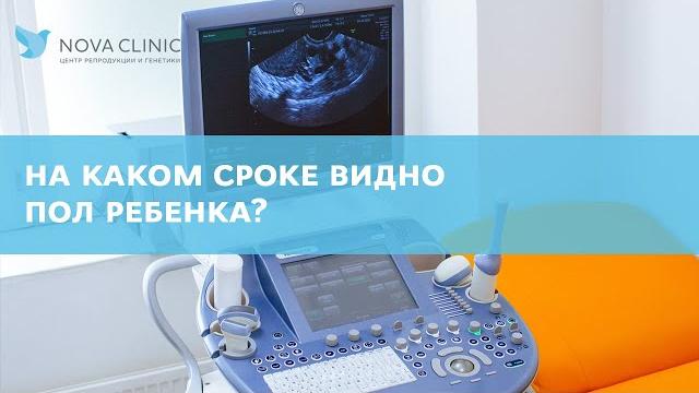 Когда видно пол ребенка на УЗИ? Когда видно пол ребенка на УЗИ?