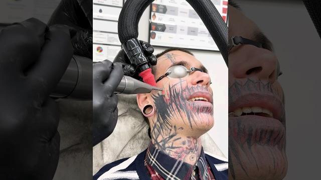 ШОК. Зачем он это сделал с собой !? УДАЛЯЕТ ТАТУ НА ЛИЦЕ. часть #2. #tattoo #рекомендации #топ #1k ШОК. Зачем он это сделал с собой !? УДАЛЯЕТ ТАТУ НА ЛИЦЕ. часть #2. #tattoo #рекомендации #топ #1k