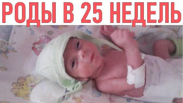 МАМИН ОПЫТ | Я родила ребенка в 25 недель МАМИН ОПЫТ | Я родила ребенка в 25 недель