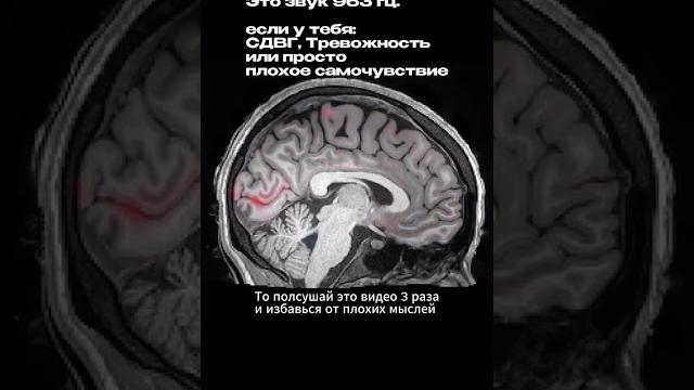 #Repost @salowhat1 ——963 Гц — звук, который перезагружает твой мозг. Вот как это работает: #Repost @salowhat1 ——963 Гц — звук, который перезагружает твой мозг. Вот как это работает: