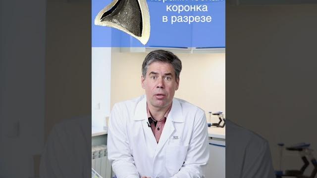 Не делайте металлокерамику на передние зубы! Не делайте металлокерамику на передние зубы!