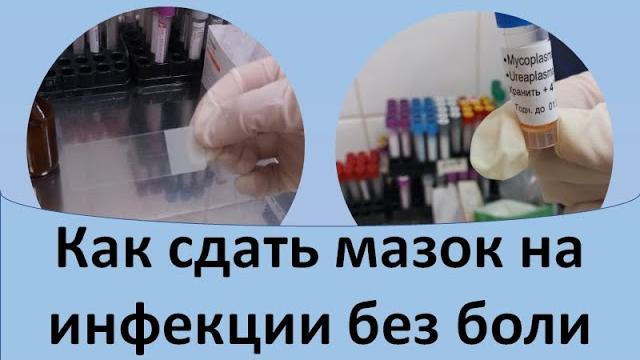 Как сдать мазок на инфекции без боли Как сдать мазок на инфекции без боли