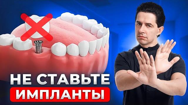 Кому нельзя ставить импланты? Стоматологи молчат об этом Кому нельзя ставить импланты? Стоматологи молчат об этом