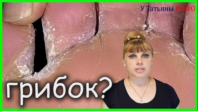 Даже запущенный грибок можно вылечить дома! Эффективное лечение грибка народным методом!!! Даже запущенный грибок можно вылечить дома! Эффективное лечение грибка народным методом!!!