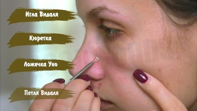 Как использовать инструменты для чистки лица от прыщей, черных точек и расширенных пор? Обзор набора Как использовать инструменты для чистки лица от прыщей, черных точек и расширенных пор? Обзор набора