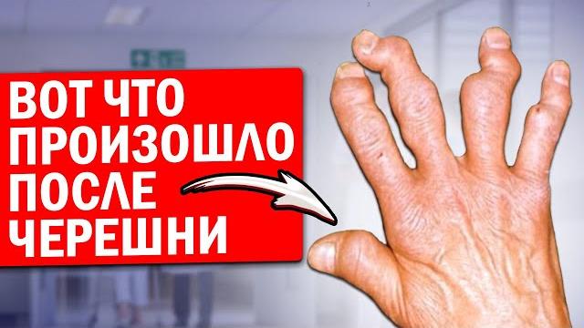Ем черешню каждый день: вот что натворила черешня с суставами, подагрой, сосудами, мозгом и даже... Ем черешню каждый день: вот что натворила черешня с суставами, подагрой, сосудами, мозгом и даже...