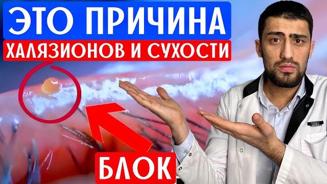 Самый лучший способ от халязионов, ячменей и сухости в глазах. Массаж век от офтальмолога. Самый лучший способ от халязионов, ячменей и сухости в глазах. Массаж век от офтальмолога.