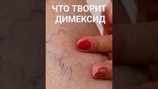 признаки ДИМЕКСИД, об этом никто не догадывается признаки ДИМЕКСИД, об этом никто не догадывается