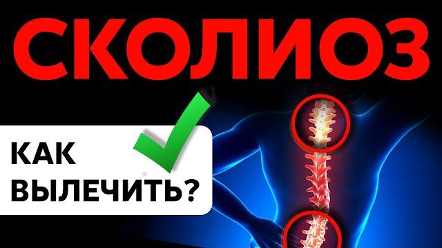 Как вылечить СКОЛИОЗ? Как вылечить СКОЛИОЗ?