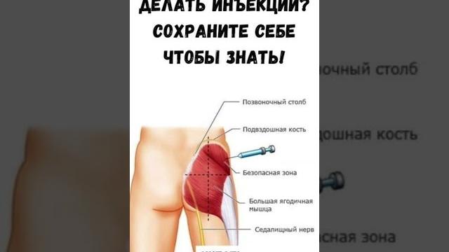 Как правильно делать инъекции? #здоровье #польза #рекамендация Как правильно делать инъекции? #здоровье #польза #рекамендация